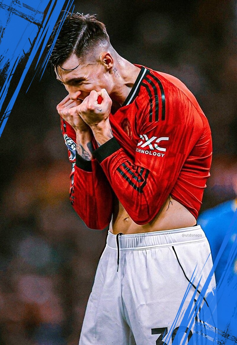 Statistik Buruk Sesko Lawan Leeds Bikin Penggemar Kecewa Berat