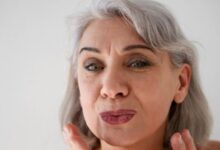 10 Best Affordable Creams to Reduce Mouth Wrinkles and Fine Lines Under Rp 100K