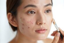 10 Best BB Creams for Acne-Prone Skin: Lightweight Yet High Coverage Recommendations