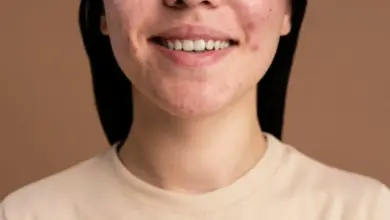 6 Recommended Skincare Products to Effectively Treat Cystic Acne, Backed by Experts