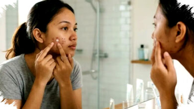 5 Acne Spot Treatments That Dry Pimples Overnight, The Most Effective Picks For Sudden Breakouts