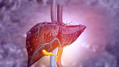 Awas Aflatoksin! Senyawa Karsinogen yang Terabaikan di Dapur Anda