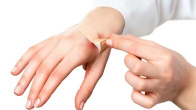 Luka Cepat Sembuh Tanpa Bekas? Ini Rahasianya Agar Kulit Anda Tetap Mulus