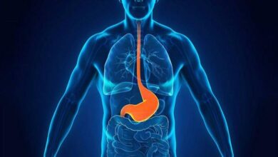 Pengobatan Gerd Masih Terbatas: Fexuprazan Tawarkan Terapi Inovatif