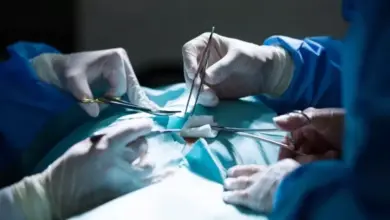 Pria di China Jalani Operasi Darurat, Belut Hidup Ditemukan di Perutnya