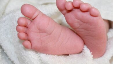 Gejala dan Penyebab Sindrom Cloves, Penyakit Langka pada Anak-anak