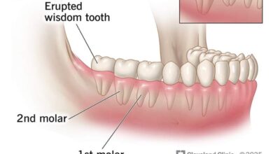 Terapi Myofungsional: Cara Merawat Gigi Anak Tanpa Kawat Gigi Efektif