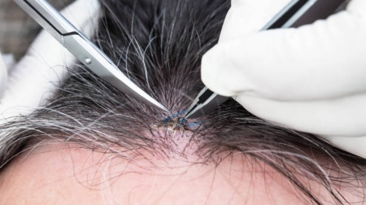 Bolehkan Mencabut Uban dalam Islam? Ini Hukum dan Ketentuan yang Perlu Kamu Tahu Bolehkan Mencabut Uban dalam Islam? Ini Hukum dan Ketentuan yang Perlu Kamu Tahu