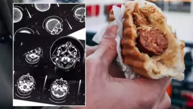 Kebiasaan Makan Daging Olahan Tingkatkan Risiko Demensia Lebih Cepat