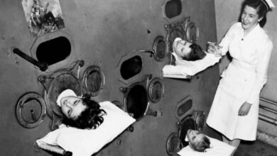 Ngeri! 10 Alat Medis Jadul yang Bikin Kita Bersyukur Hidup di Era Modern