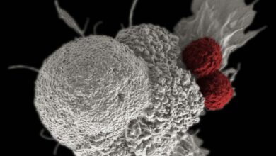 AstraZeneca Hadirkan Terapi Inovatif Sembuhkan Pasien Kanker Payudara