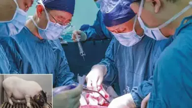 Sejarah Baru Medis: Transplantasi Hati Babi Berhasil pada Manusia Pertama Kali