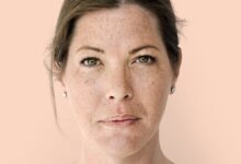 10 Serum Wajah untuk Bruntusan di Bawah Rp 150 Ribu, Bantu Cerahkan Kulit secara Efektif