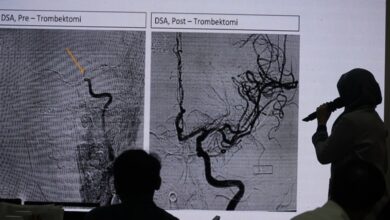 Jangan Lewatkan Detik Penting: Menit Krusial Selamatkan Nyawa Pasien Aritmia dan Stroke