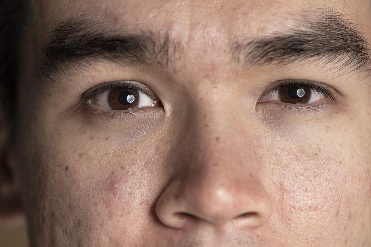 10 Rekomendasi Toner untuk Wajah Bruntusan di Bawah Rp120 Ribu, Kualitas Terbukti Aman