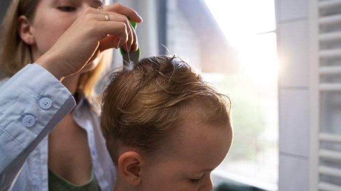 6 Rekomendasi Hair Lotion Bayi Terbaik agar Rambut Tumbuh Lebat dan Sehat