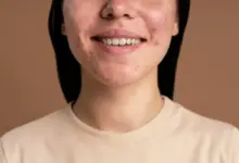 6 Rekomendasi Skincare untuk Jerawat Batu, Efektif Redakan Noda dan Meredakan Peradangan