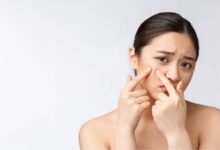 7 Rekomendasi Obat Totol Jerawat Lokal Terbaik untuk Mengatasi Jerawat Membandel