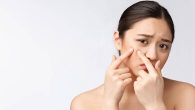 7 Rekomendasi Obat Totol Jerawat Lokal Terbaik untuk Mengatasi Jerawat Membandel