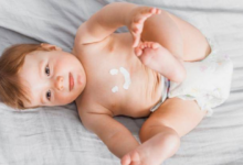 7 Rekomendasi Telon Cream Terbaik untuk Bayi: Aman, Lembut, dan Mudah Digunakan