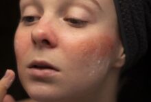 9 Rekomendasi Krim Malam untuk Kulit Sensitif, Bebas Iritasi dan Harganya di Bawah Rp150 Ribu