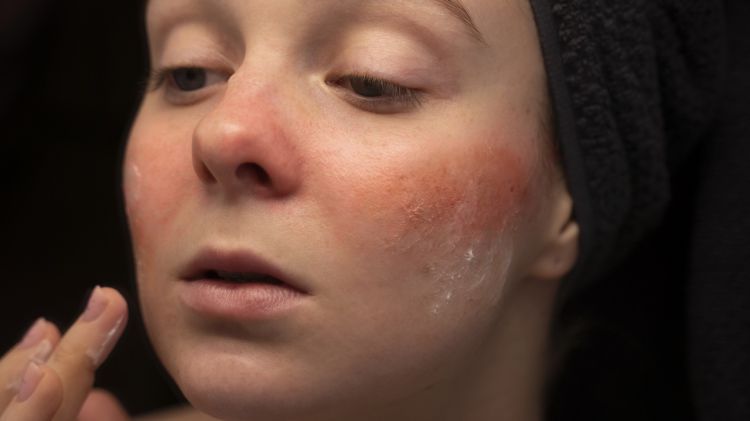 9 Rekomendasi Krim Malam untuk Kulit Sensitif, Bebas Iritasi dan Harganya di Bawah Rp150 Ribu