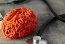 Ancaman Nyata Stroke: Kenali Gejala, Penyebab, Risiko, dan Cara Pengobatan Efektif