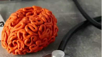 Ancaman Nyata Stroke: Kenali Gejala, Penyebab, Risiko, dan Cara Pengobatan Efektif