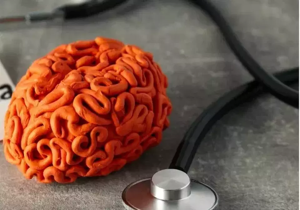 Ancaman Nyata Stroke: Kenali Gejala, Penyebab, Risiko, dan Cara Pengobatan Efektif