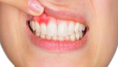 Bahaya Penyakit Gusi pada Ibu Hamil: Risiko Diabetes dan Stroke Meningkat Signifikan