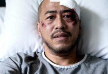 Benarkah Pandji Pragiwaksono Dibuat Babak Belur dan Ditangkap Polisi? Fakta Terbaru!