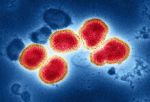 Kasus Flu H3N2 Melonjak di China: Gejala, Penyebab, dan Cara Penanganannya Terbaru