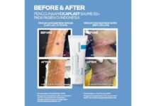 La Roche Posay Cicaplast Baume B5+: Ulasan, Fungsi, dan Hal yang Perlu Diketahui Sebelum Membeli