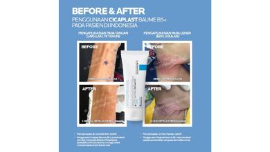 La Roche Posay Cicaplast Baume B5+: Ulasan, Fungsi, dan Hal yang Perlu Diketahui Sebelum Membeli