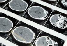 Studi Baru Ungkap Otak Manusia Lewati Lima Tahap Perkembangan Utama secara Mendetail