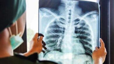 Tantangan Kompleks Bedah Bahu, RS Ini Hadirkan Pakar Dunia Beri Solusi Medis Terbaik