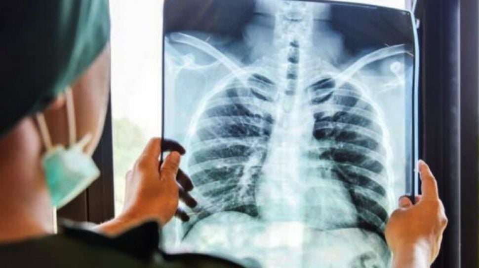 Tantangan Kompleks Bedah Bahu, RS Ini Hadirkan Pakar Dunia Beri Solusi Medis Terbaik