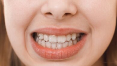 Gigi Goyang Dewasa? Kenali Penyebab dan Cara Mengatasinya Sebelum Parah Terjadi