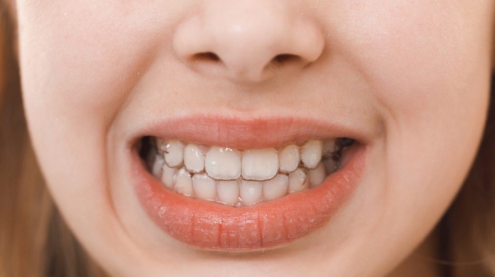 Gigi Goyang Dewasa? Kenali Penyebab dan Cara Mengatasinya Sebelum Parah Terjadi