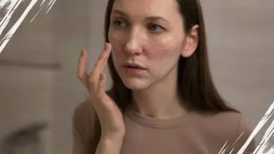 Ini 5 Skincare Terbaik untuk Hilangkan Bopeng Bekas Jerawat, Harga Mulai Rp20 Ribuan