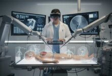 Keuntungan Operasi dengan Teknologi Robotik: Prosedur Ringan dan Pemulihan Lebih Singkat