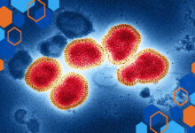 Mengenal Perbedaan Superflu dan Flu Biasa serta Dampak Risiko Kesehatannya