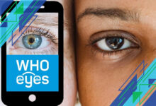 Mengenal Ptosis: Penyebab Mata Terlihat Mengantuk dan Cara Mengatasinya dengan Efektif