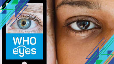 Mengenal Ptosis: Penyebab Mata Terlihat Mengantuk dan Cara Mengatasinya dengan Efektif