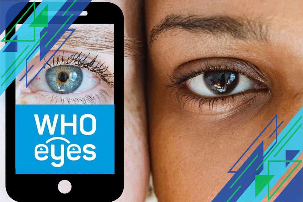 Mengenal Ptosis: Penyebab Mata Terlihat Mengantuk dan Cara Mengatasinya dengan Efektif