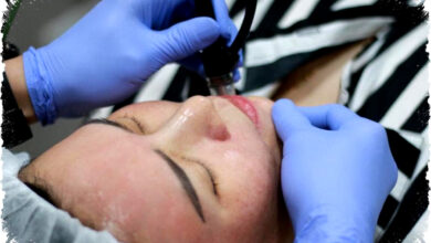 Miracle Aesthetic Clinic Tangani Hiperpigmentasi Kulit Indonesia Lewat Terapi Laser dan Peeling Canggih Yang Terbukti Efektif
