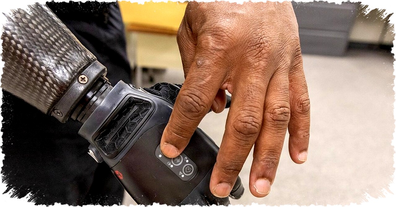 Neural-Enabled Prosthetic Hand: Teknologi Baru yang Membuat Tentara Merasakan Sentuhan Lagi