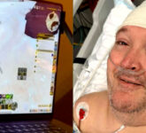 100 Hari dengan Neuralink, Veteran Lumpuh Kini Mengendalikan Mac dan Main Warcraft dengan Pikiran