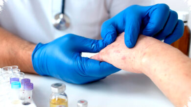 Kemenkes Selidiki Kematian Dokter Muda Diduga Campak, Jejak Penularan Di Cianjur Diurai