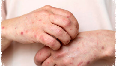 Jejak Sifilis Kuno di Vietnam Mengguncang Teori Asal Usulnya, Bukan Dari Amerika?